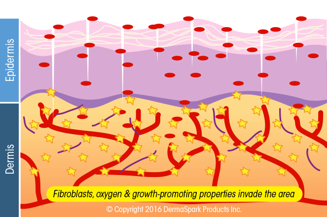 Microneedling Niagara