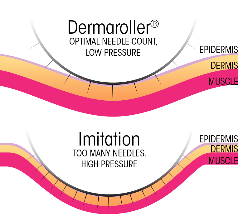 Micro-needling Niagara